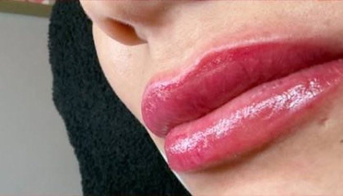 Después de micropigmentación de labios