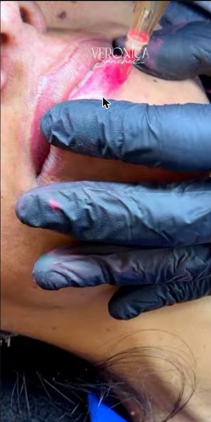 Proceso de micropigmentación de labios