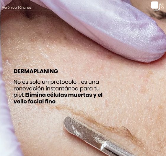 Dermaplaning