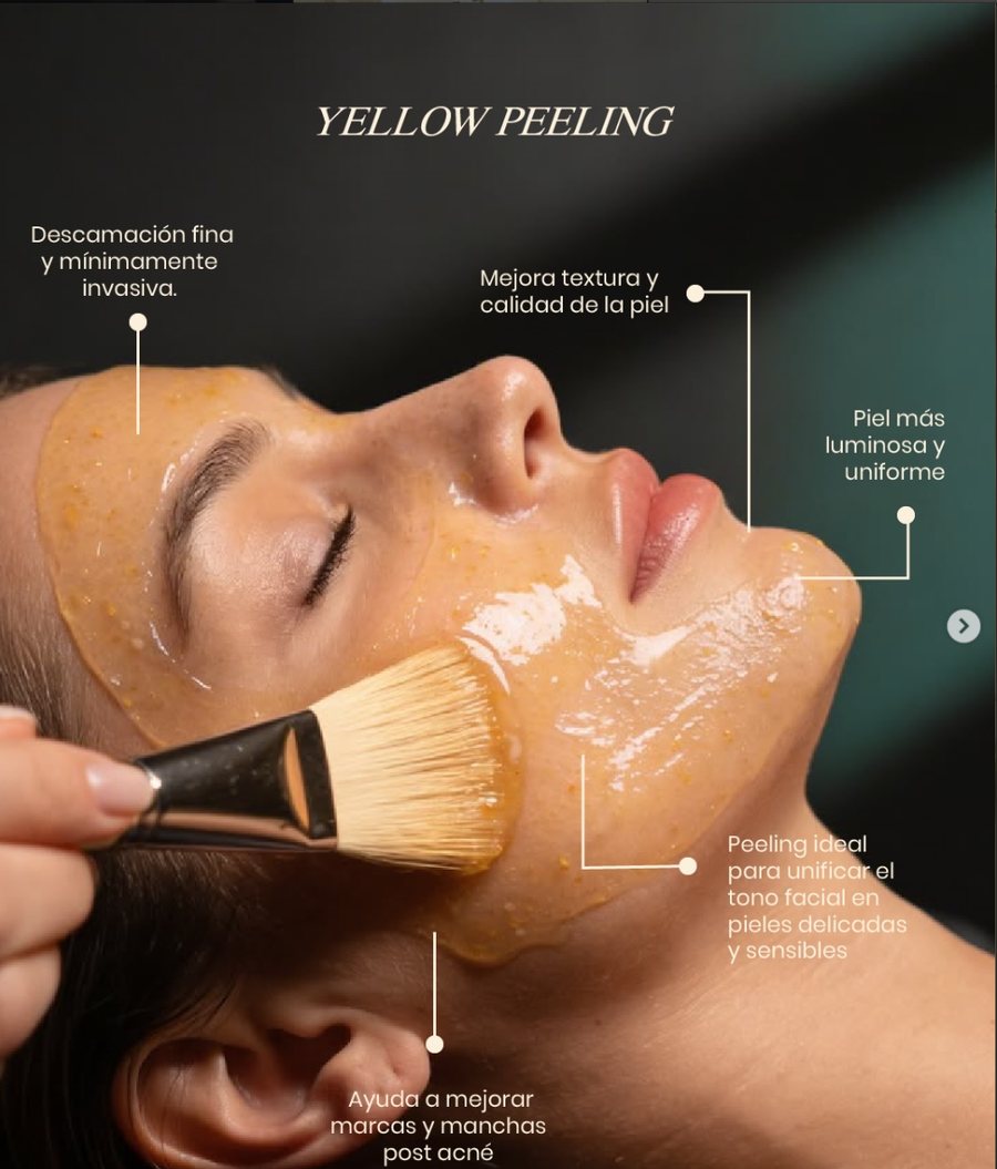Peeling